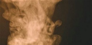 Vâlcea: Tragedie în comuna Bărbătești – o fetiță de 12 ani a murit intoxicată cu fumul de la sobă