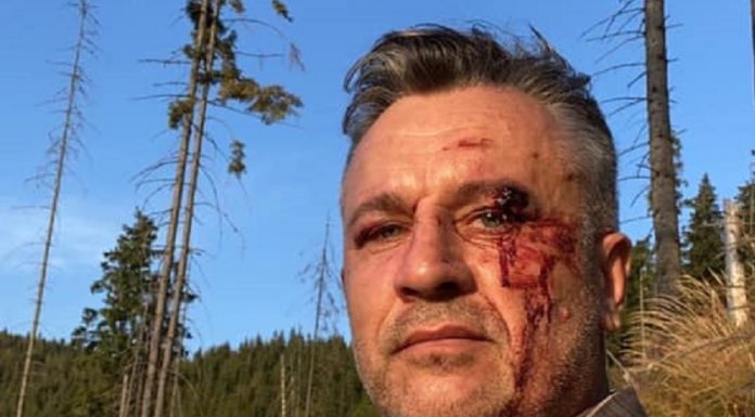 Tăierile ilegale din păduri fac noi victime – un activist de mediu și doi jurnaliști au ajuns la spital
