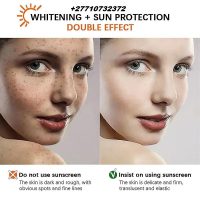 Skin Bleaching And Whitening Products In Smögen Municipality in Sweden Call +27710732372